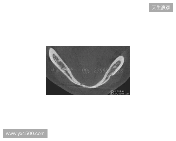 韦林顿确诊上唇部贯通伤；11、21牙半脱位；上颌前牙区牙槽骨骨折